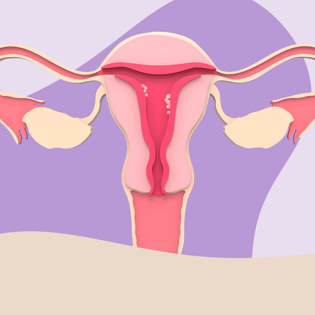 Can you name the five gynaecological cancers? Here's what you need to know